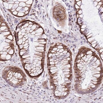 Anti-NACC2 antibody produced in rabbit Prestige Antibodies&#174; Powered by Atlas Antibodies, affinity isolated antibody, buffered aqueous glycerol solution