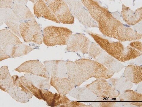 Monoclonal Anti-CASQ2, (C-terminal) antibody produced in mouse clone 1C6, purified immunoglobulin, buffered aqueous solution