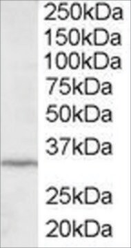 Anti-ING2/ING1L antibody produced in goat affinity isolated antibody, buffered aqueous solution