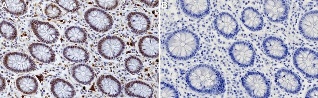 Anti-XRCC4 Antibody, clone 3I9 ZooMAb&#174; Rabbit Monoclonal recombinant, expressed in HEK 293 cells