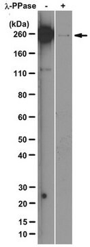 Anti-RNA polymerase II subunit B1 (phospho-CTD Ser-5) Antibody, clone 3E8 clone 3E8, from rat