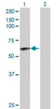 Anti-CAMK2D antibody produced in rabbit purified immunoglobulin, buffered aqueous solution