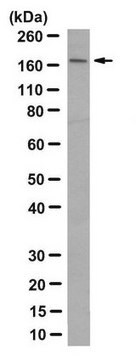 Anti-SETBP1 Antibody, clone 63 clone 63, from mouse