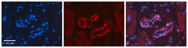 Anti-SPRY2 antibody produced in rabbit affinity isolated antibody