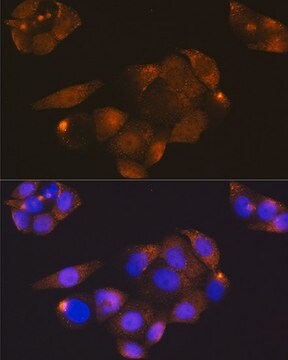 Anti- CDK4 antibody produced in rabbit