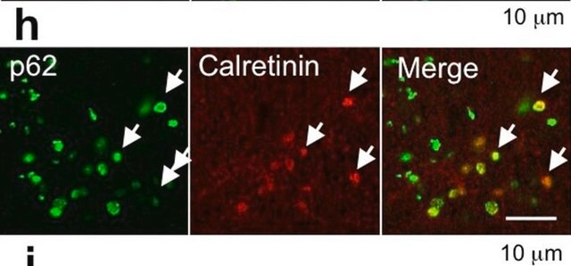 Anti-Calretinin Antibody, clone 6B8.2 clone 6B8.2, Chemicon&#174;, from mouse