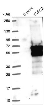 Anti-TSEN2 antibody produced in rabbit Prestige Antibodies&#174; Powered by Atlas Antibodies, affinity isolated antibody, buffered aqueous glycerol solution, ab2