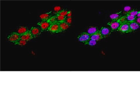 Anti-Neurogenin-3 Antibody, a.a. 80-93 of mouse Neurogenin-3. Chemicon&#174;, from rabbit