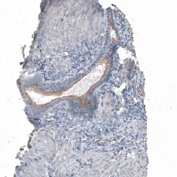 Anti-FGFR2 antibody produced in rabbit Prestige Antibodies&#174; Powered by Atlas Antibodies, affinity isolated antibody, buffered aqueous glycerol solution