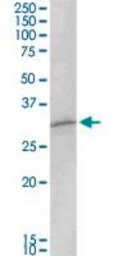 Anti-MAGEA8 antibody produced in rabbit purified immunoglobulin, buffered aqueous solution