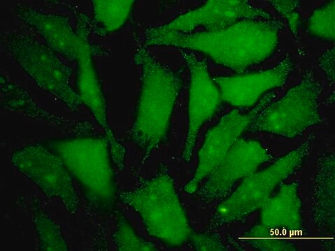 Monoclonal Anti-MGAT4B antibody produced in mouse clone 1F4, purified immunoglobulin, buffered aqueous solution