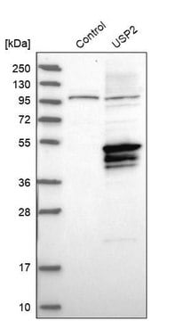 Anti-USP2 antibody produced in rabbit Ab1, Prestige Antibodies&#174; Powered by Atlas Antibodies, affinity isolated antibody, buffered aqueous glycerol solution