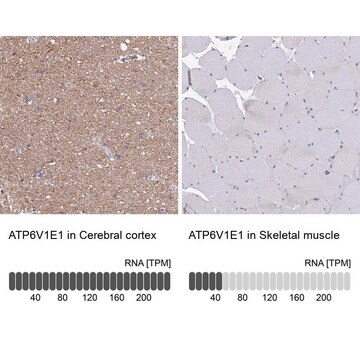 Anti-ATP6V1E1 antibody produced in rabbit Prestige Antibodies&#174; Powered by Atlas Antibodies, affinity isolated antibody, buffered aqueous glycerol solution