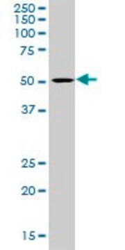 Anti-LIPA antibody produced in rabbit purified immunoglobulin, buffered aqueous solution