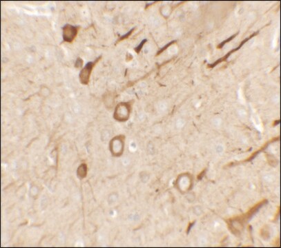 Anti-PRRT2 antibody produced in rabbit affinity isolated antibody, buffered aqueous solution