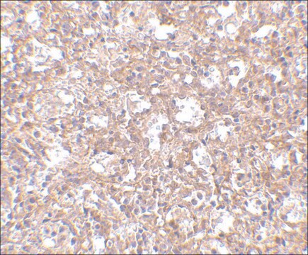 Anti-TEM4 antibody produced in rabbit affinity isolated antibody, buffered aqueous solution