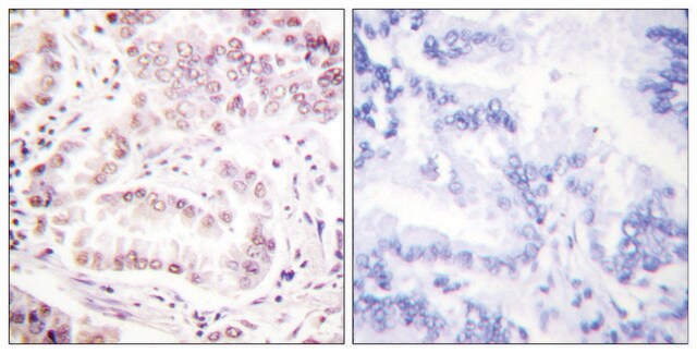 Anti-Histone H3 (Acetyl-Lys27) antibody produced in rabbit affinity isolated antibody