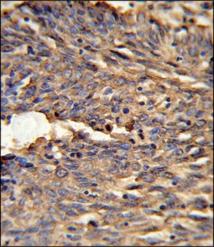 ANTI-HBA2 (CENTER) antibody produced in rabbit IgG fraction of antiserum, buffered aqueous solution