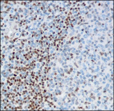 Anti-FOXP1 antibody, Rabbit monoclonal clone SP133, recombinant, expressed in proprietary host, affinity isolated antibody