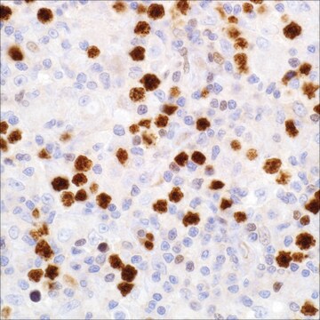 FoxP1 (SP133) Rabbit Monoclonal Antibody