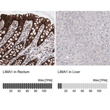 Anti-LIMA1 antibody produced in rabbit Prestige Antibodies&#174; Powered by Atlas Antibodies, affinity isolated antibody, buffered aqueous glycerol solution