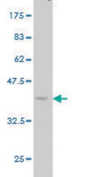 Monoclonal Anti-ACVRL1 antibody produced in mouse clone 5B1, purified immunoglobulin, buffered aqueous solution