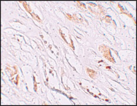 Anti-PEAR1 antibody produced in rabbit affinity isolated antibody, buffered aqueous solution