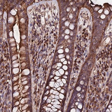 Anti-EXT1 antibody produced in rabbit Prestige Antibodies&#174; Powered by Atlas Antibodies, affinity isolated antibody, buffered aqueous glycerol solution