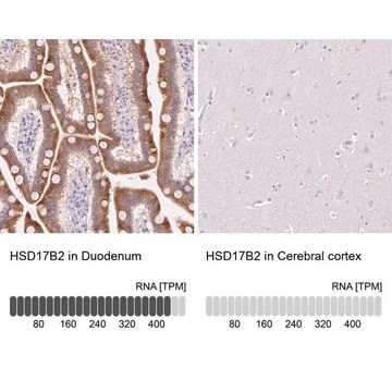 Anti-HSD17B2 antibody produced in rabbit Prestige Antibodies&#174; Powered by Atlas Antibodies, affinity isolated antibody, buffered aqueous glycerol solution