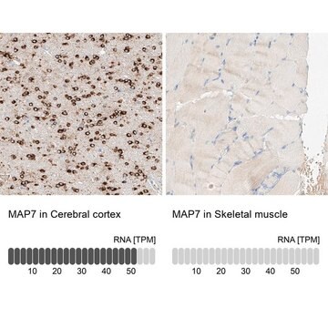 Anti-MAP7 antibody produced in rabbit Prestige Antibodies&#174; Powered by Atlas Antibodies, affinity isolated antibody, buffered aqueous glycerol solution, ab1