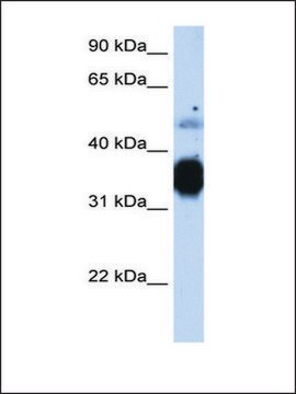 Anti-TNNT3 antibody produced in rabbit IgG fraction of antiserum