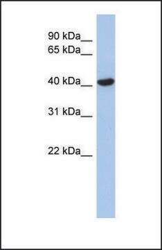 Anti-ZFYVE1, (N-terminal) antibody produced in rabbit affinity isolated antibody