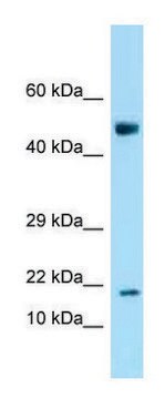 Anti-Ankrd37 (N-terminal) antibody produced in rabbit affinity isolated antibody