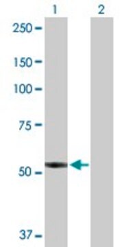 Anti-PTGIS antibody produced in rabbit purified immunoglobulin, buffered aqueous solution