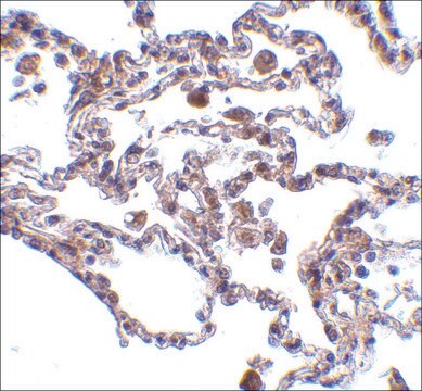 Anti-CIKS antibody produced in rabbit affinity isolated antibody, buffered aqueous solution