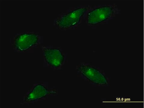 Anti-MGAT1 antibody produced in mouse IgG fraction of antiserum, buffered aqueous solution