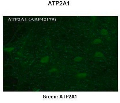 Anti-ATP2A1, (N-terminal) antibody produced in rabbit affinity isolated antibody