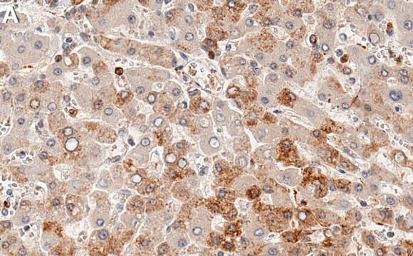 Anti-GCLM Antibody, clone 1D19 ZooMAb&#174; Rabbit Monoclonal recombinant, expressed in HEK 293 cells