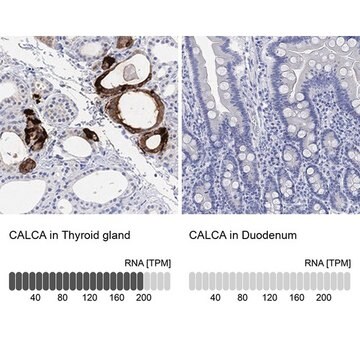 Anti-CALCA antibody produced in rabbit Prestige Antibodies&#174; Powered by Atlas Antibodies, affinity isolated antibody, buffered aqueous glycerol solution