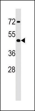 ANTI-MOUSE HOXA2 (CENTER) antibody produced in rabbit IgG fraction of antiserum, buffered aqueous solution