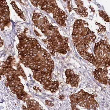 Anti-SLC39A6 antibody produced in rabbit Prestige Antibodies&#174; Powered by Atlas Antibodies, affinity isolated antibody, buffered aqueous glycerol solution