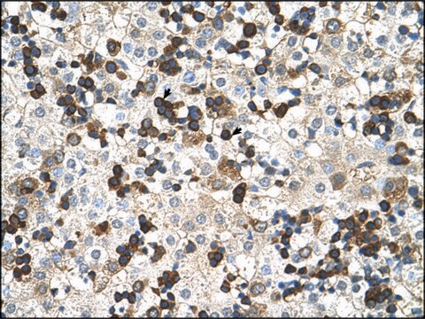 Anti-HBZ antibody produced in rabbit IgG fraction of antiserum