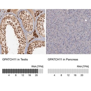 Anti-GPATCH11 antibody produced in rabbit Prestige Antibodies&#174; Powered by Atlas Antibodies, affinity isolated antibody, buffered aqueous glycerol solution