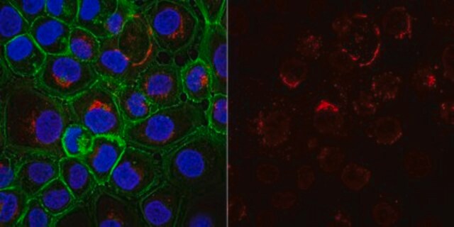 Anti-Cytokeratin 5,6 Antibody, clone D5/16B4, Alexa Fluor&#8482; 555 clone D5/16B4, from mouse, ALEXA FLUOR&#8482; 555