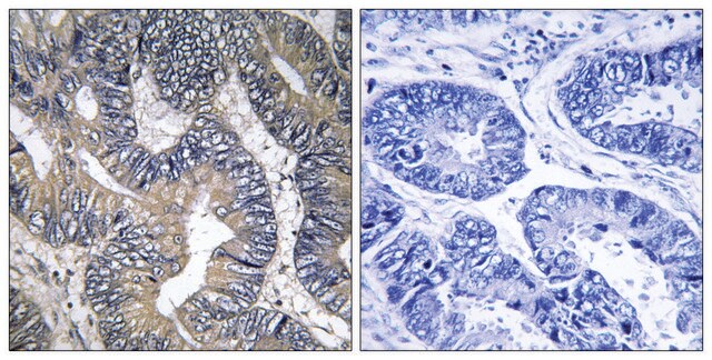 Anti-GTPBP2 antibody produced in rabbit affinity isolated antibody