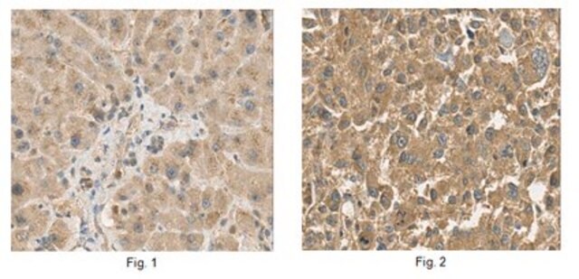 Anti-Serpinf2 Antibody from rabbit, purified by affinity chromatography