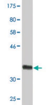 Monoclonal Anti-HSD3B2 antibody produced in mouse clone 1E8, purified immunoglobulin, buffered aqueous solution