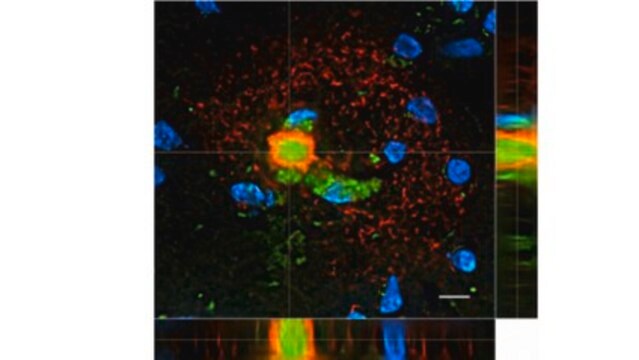 Anti-Amyloid Beta 3NTyr10 Antibody, clone 4A5E8 clone 4A5E8, from mouse