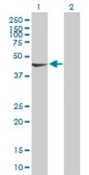 Anti-PDK2 antibody produced in mouse purified immunoglobulin, buffered aqueous solution