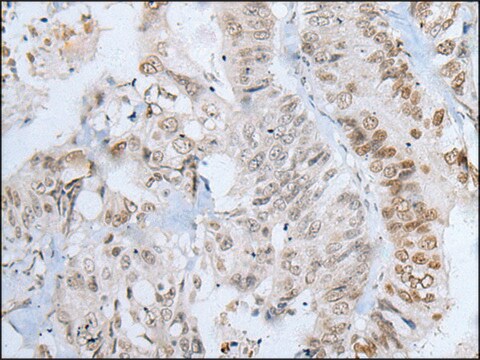 Anti-ZNF143 affinity isolated antibody